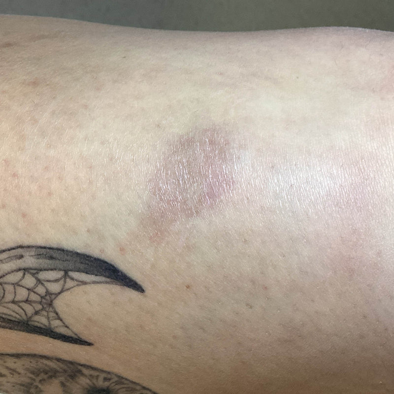 After treatment