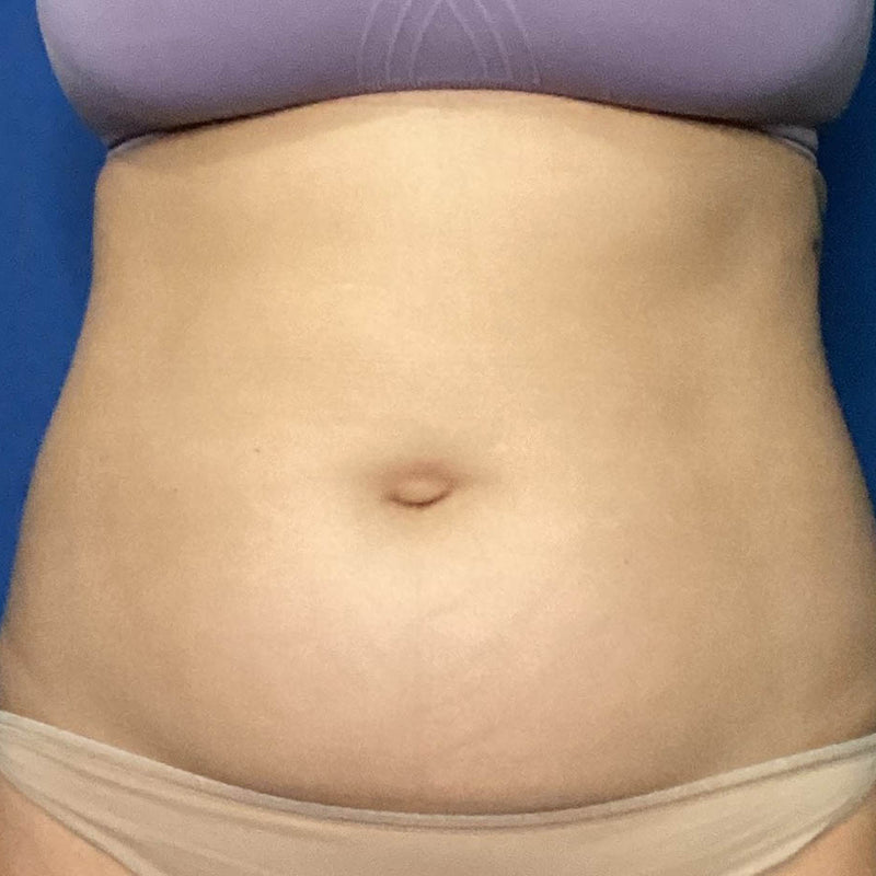Before treatment
