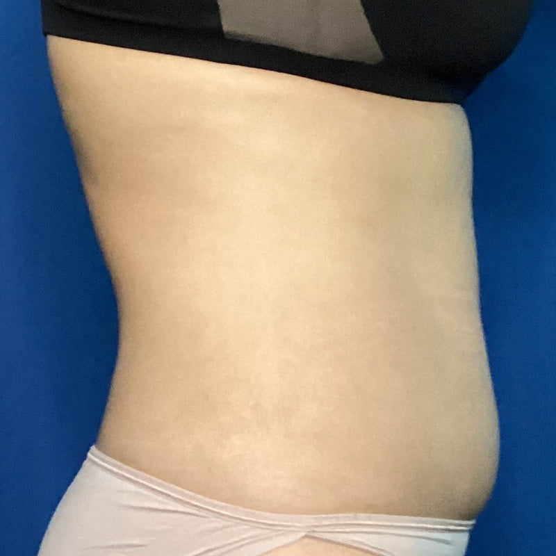 After treatment