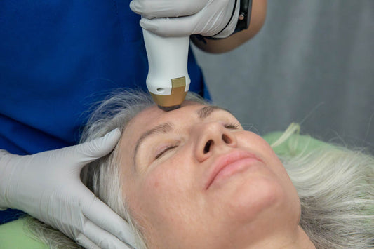 Fractional Resurfacing treatment on patients forehead at Chinn GYN