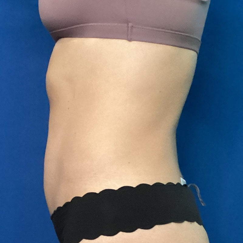 After treatment