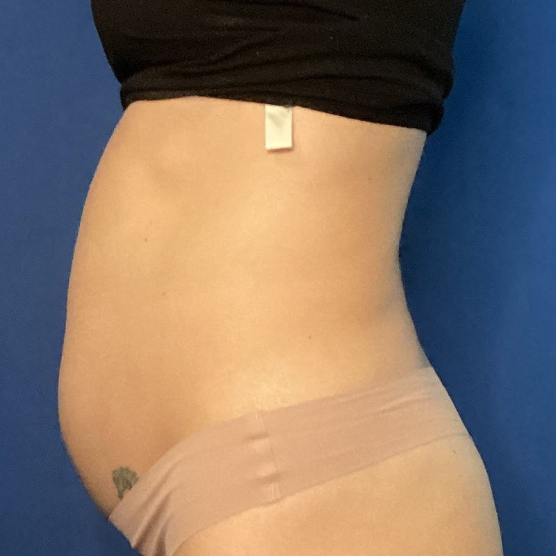 Before treatment