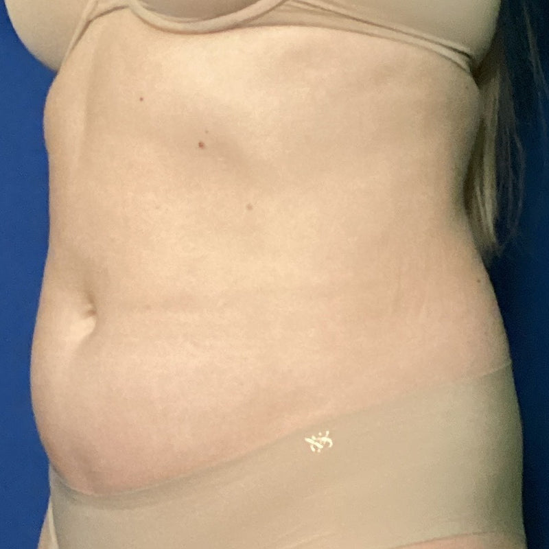 Before treatment